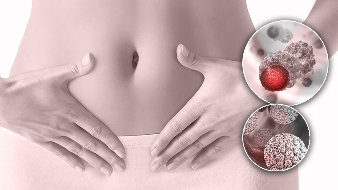 Lo screening HPV al Pelvic Point
